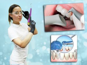 Отбеливание зубов Air flow: один из этапов чистки эмали