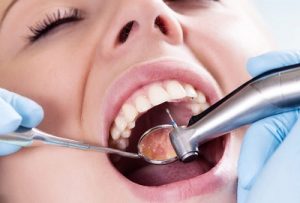 Какие существуют современные методы лечения зубов?