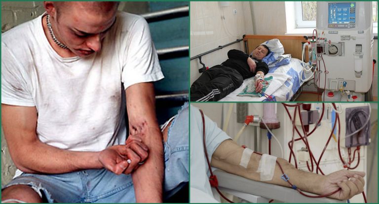 Современные способы лечения наркомании