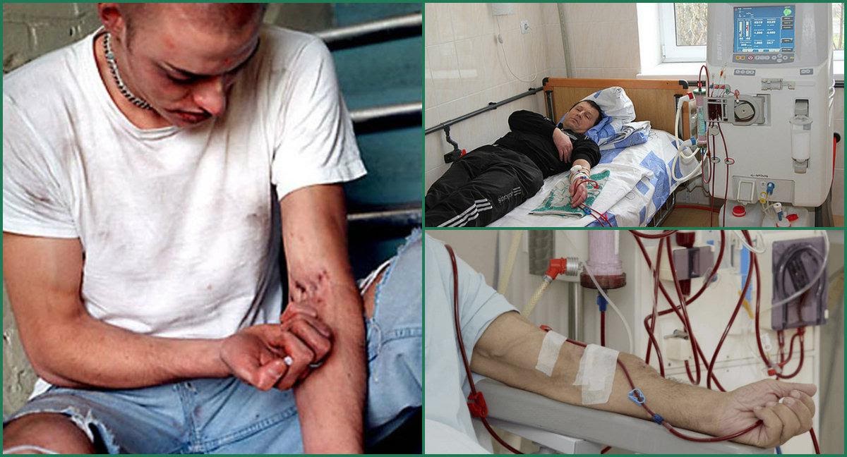 Методы лечения наркомании