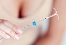 Как проходит удаление ВМС?