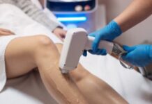 Лазерная эпиляция: безопасное удаление волос