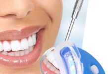 Для чего необходимо отбеливание зубов?