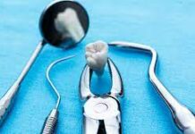 Удаление зубов в современной стоматологии