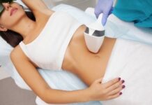 Лазерная эпиляция живота