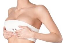 Этапы проведения операции по подтяжке груди