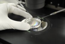 Метода ИКСИ: передовые аспекты экстракорпорального оплодотворения