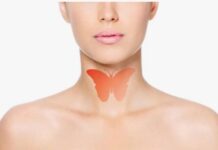 Тиреотоксикоз: Симптомы, Причины и Лечение