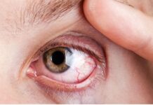 Диабетическая ретинопатия: механизм развития и методы лечения