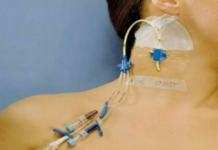 Зачем нужен центральный венозный катетер