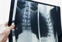 Рентген позвоночника