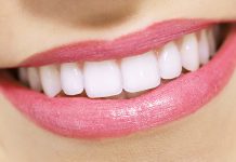 Как выбрать стоматологию для имплантации зубов: 7 ключевых критериев